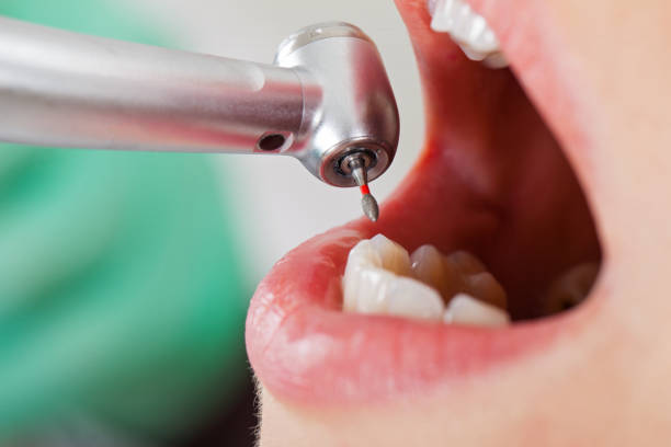 Best Emergency Treatment for Dental Infections or Abscesses in Ethete, WY